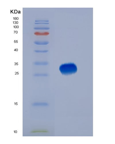 SDS-PAGE analysis of Human BSG (Basigin) - Recombinant Protein, CAT# BLT-05806P, showing >90% purity under 15% SDS-PAGE (Reduced)Human BSG (Basigin) - Recombinant Protein