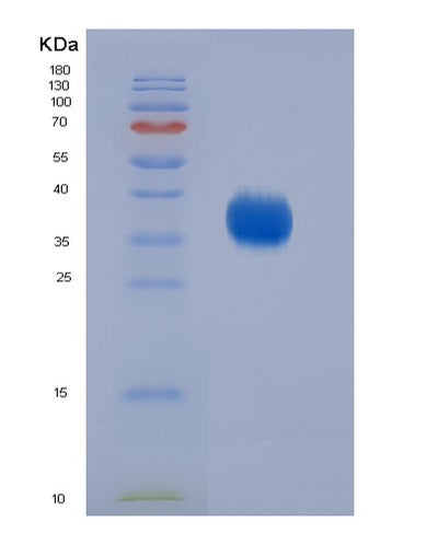 SDS-PAGE analysis of Human CD2 (T-Cell Surface Antigen Cd2) - Recombinant Protein, CAT# BLT-04803P, showing >95% purity under 15% SDS-PAGE (Reduced)Human CD2 (T-Cell Surface Antigen Cd2) - Recombinant Protein