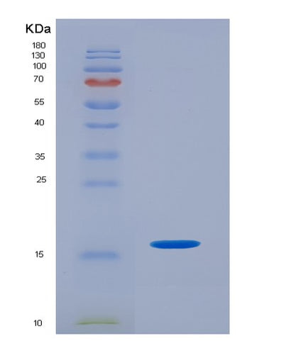 SDS-PAGE analysis of Human CD3E (T-Cell Surface Glycoprotein Cd3 Epsilon Chain) - Recombinant Protein, CAT# BLT-05766P, showing >90% purity under 15% SDS-PAGE (Reduced)Human CD3E (T-Cell Surface Glycoprotein Cd3 Epsilon Chain) - Recombinant Protein
