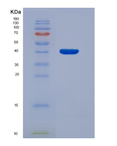 SDS-PAGE analysis of Human CD3E (T-Cell Surface Glycoprotein Cd3 Epsilon Chain) - Recombinant Protein, CAT# BLT-04006P, showing >95% purity under 15% SDS-PAGE (Reduced)Human CD3E (T-Cell Surface Glycoprotein Cd3 Epsilon Chain) - Recombinant Protein