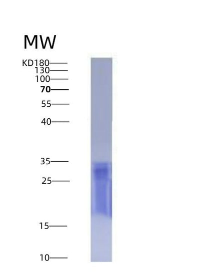 SDS-PAGE analysis of Human CD6 (T-Cell Differentiation Antigen Cd6) - Recombinant Protein, CAT# BLT-04380P, showing >90% purity under 15% SDS-PAGE (Reduced)Human CD6 (T-Cell Differentiation Antigen Cd6) - Recombinant Protein