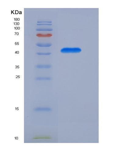 SDS-PAGE analysis of Human CD8B (T-Cell Surface Glycoprotein Cd8 Beta Chain) - Recombinant Protein, CAT# BLT-03685P, showing >90% purity under 15% SDS-PAGE (Reduced)Human CD8B (T-Cell Surface Glycoprotein Cd8 Beta Chain) - Recombinant Protein