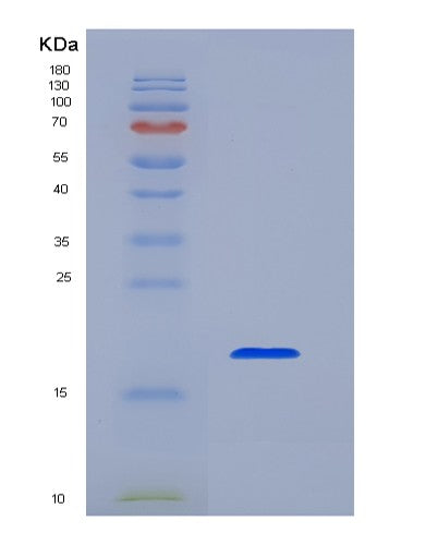 SDS-PAGE analysis of Human MS4A1 (B-Lymphocyte Antigen Cd20) - Recombinant Protein, CATHuman MS4A1 (B-Lymphocyte Antigen Cd20) - Recombinant Protein