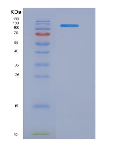 SDS-PAGE analysis of Human CD22 (B-Cell Receptor Cd22) - Recombinant Protein, CAT# BLT-06094P, showing >90% purity under 15% SDS-PAGE (Reduced)Human CD22 (B-Cell Receptor Cd22) - Recombinant Protein