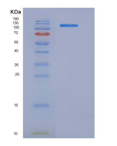 SDS-PAGE analysis of Human CD22 (B-Cell Receptor Cd22) - Recombinant Protein, CATHuman CD22 (B-Cell Receptor Cd22) - Recombinant Protein
