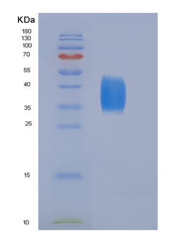 SDS-PAGE analysis of Human CD28 (T-Cell-Specific Surface Glycoprotein Cd28) - Recombinant Protein, CAT# BLT-05243P, showing >90% purity under 15% SDS-PAGE (Reduced)Human CD28 (T-Cell-Specific Surface Glycoprotein Cd28) - Recombinant Protein