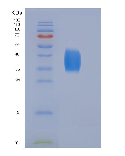 SDS-PAGE analysis of Human CD28 (T-Cell-Specific Surface Glycoprotein Cd28) - Recombinant Protein, CATHuman CD28 (T-Cell-Specific Surface Glycoprotein Cd28) - Recombinant Protein