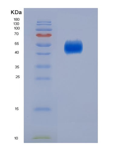 SDS-PAGE analysis of Human CD80 (T-Lymphocyte Activation Antigen Cd80) - Recombinant Protein, CAT# BLT-07032P, showing >95% purity under 15% SDS-PAGE (Reduced)Human CD80 (T-Lymphocyte Activation Antigen Cd80) - Recombinant Protein