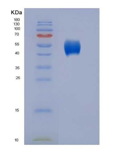 SDS-PAGE analysis of Human CD86 (T-Lymphocyte Activation Antigen Cd86) - Recombinant Protein, CAT# BLT-07030P, showing >95% purity under 15% SDS-PAGE (Reduced)Human CD86 (T-Lymphocyte Activation Antigen Cd86) - Recombinant Protein