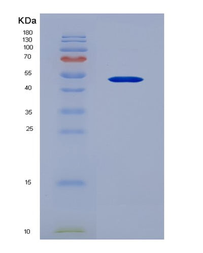 SDS-PAGE analysis of Human CD33 (Myeloid Cell Surface Antigen Cd33) - Recombinant Protein, CAT# BLT-06079P, showing >95% purity under 15% SDS-PAGE (Reduced)Human CD33 (Myeloid Cell Surface Antigen Cd33) - Recombinant Protein
