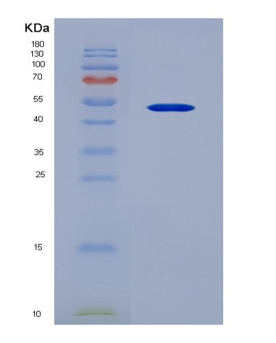 SDS-PAGE analysis of Human CD33 (Myeloid Cell Surface Antigen Cd33) - Recombinant Protein, CATHuman CD33 (Myeloid Cell Surface Antigen Cd33) - Recombinant Protein
