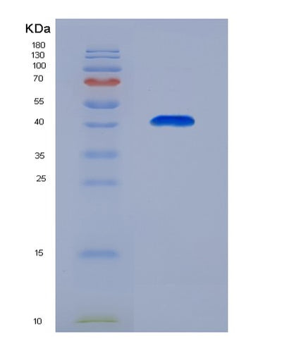 SDS-PAGE analysis of Human CD59 (Cd59 Glycoprotein) - Recombinant Protein, CAT# BLT-06783P, showing >95% purity under 15% SDS-PAGE (Reduced)Human CD59 (Cd59 Glycoprotein) - Recombinant Protein
