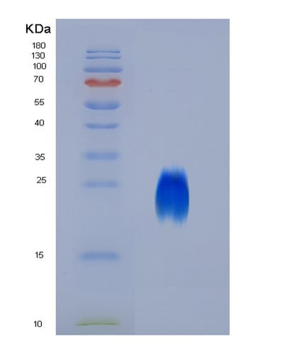 SDS-PAGE analysis of Human CD63 (Cd63 Antigen) - Recombinant Protein, CAT# BLT-06122P, showing >90% purity under 15% SDS-PAGE (Reduced)Human CD63 (Cd63 Antigen) - Recombinant Protein