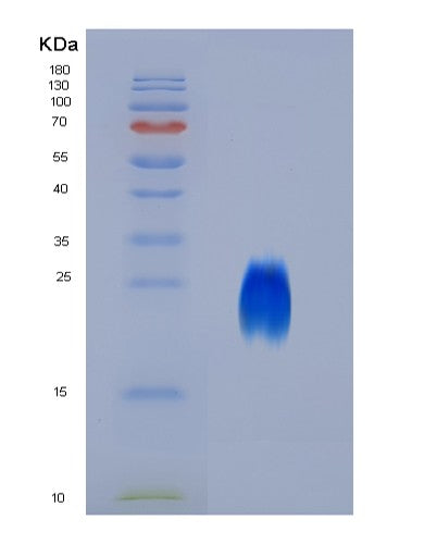 SDS-PAGE analysis of Human CD63 (Cd63 Antigen) - Recombinant Protein, CATHuman CD63 (Cd63 Antigen) - Recombinant Protein
