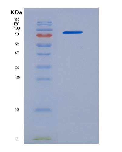 SDS-PAGE analysis of Human EGFR (Epidermal Growth Factor Receptor) - Recombinant Protein, CATHuman EGFR (Epidermal Growth Factor Receptor) - Recombinant Protein