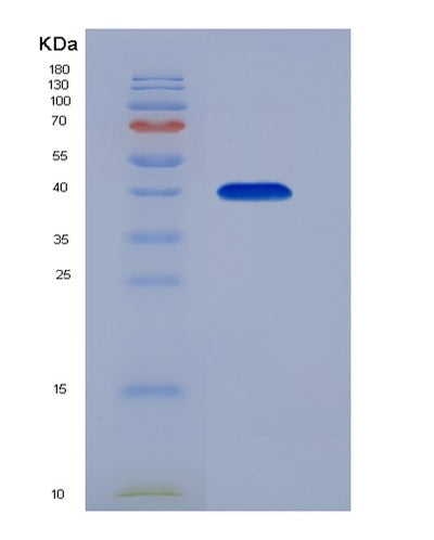 SDS-PAGE analysis of Human FCER2 (Low Affinity Immunoglobulin Epsilon Fc Receptor) - Recombinant Protein, CAT# BLT-04100P, showing >90% purity under 15% SDS-PAGE (Reduced)Human FCER2 (Low Affinity Immunoglobulin Epsilon Fc Receptor) - Recombinant Protein