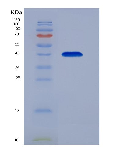 SDS-PAGE analysis of Human FCER2 (Low Affinity Immunoglobulin Epsilon Fc Receptor) - Recombinant Protein, CATHuman FCER2 (Low Affinity Immunoglobulin Epsilon Fc Receptor) - Recombinant Protein
