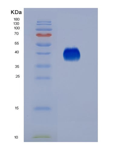 SDS-PAGE analysis of Human FCGR3A (Low Affinity Immunoglobulin Gamma Fc Region Receptor Iii-A) - Recombinant Protein, CAT# BLT-05851P, showing >95% purity under 15% SDS-PAGE (Reduced)Human FCGR3A (Low Affinity Immunoglobulin Gamma Fc Region Receptor Iii-A) - Recombinant Protein