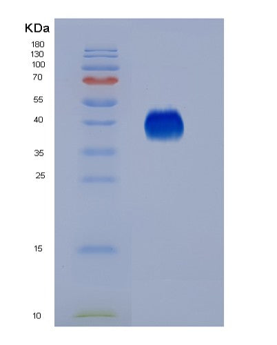SDS-PAGE analysis of Human FCGR3A (Low Affinity Immunoglobulin Gamma Fc Region Receptor Iii-A) - Recombinant Protein, CATHuman FCGR3A (Low Affinity Immunoglobulin Gamma Fc Region Receptor Iii-A) - Recombinant Protein
