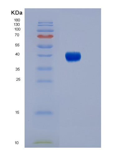 SDS-PAGE analysis of Human FCGR3B (Low Affinity Immunoglobulin Gamma Fc Region Receptor Iii-B) - Recombinant Protein, CATHuman FCGR3B (Low Affinity Immunoglobulin Gamma Fc Region Receptor Iii-B) - Recombinant Protein