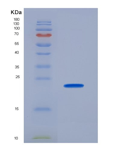 SDS-PAGE analysis of Human FGF4 (Fibroblast Growth Factor 4) - Recombinant Protein, CATHuman FGF4 (Fibroblast Growth Factor 4) - Recombinant Protein