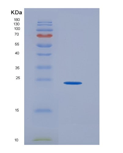 SDS-PAGE analysis of Human GH1 (Somatotropin) - Recombinant Protein, CATHuman GH1 (Somatotropin) - Recombinant Protein