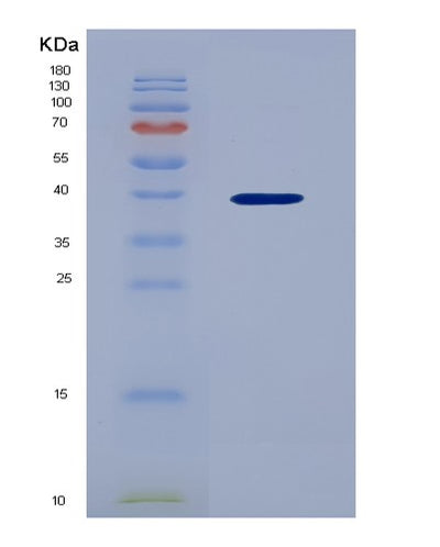 SDS-PAGE analysis of Human CXCL3 (C-X-C Motif Chemokine 3) - Recombinant Protein, CAT# BLT-04099P, showing >95% purity under 15% SDS-PAGE (Reduced)Human CXCL3 (C-X-C Motif Chemokine 3) - Recombinant Protein