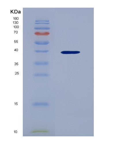 SDS-PAGE analysis of Human CXCL3 (C-X-C Motif Chemokine 3) - Recombinant Protein, CATHuman CXCL3 (C-X-C Motif Chemokine 3) - Recombinant Protein