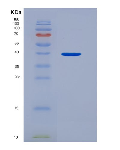 SDS-PAGE analysis of Human HDGF (Hepatoma-Derived Growth Factor) - Recombinant Protein, CAT# BLT-03819P, showing >90% purity under 15% SDS-PAGE (Reduced)Human HDGF (Hepatoma-Derived Growth Factor) - Recombinant Protein