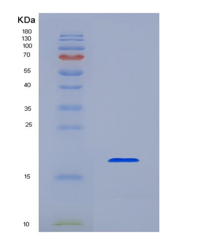 SDS-PAGE analysis of Human IL1B (Interleukin-1 Beta) - Recombinant Protein, CAT# BLT-04021P, showing >95% purity under 15% SDS-PAGE (Reduced)Human IL1B (Interleukin-1 Beta) - Recombinant Protein