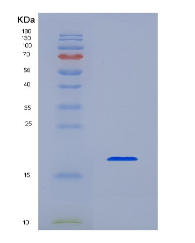SDS-PAGE analysis of Human IL1B (Interleukin-1 Beta) - Recombinant Protein, CATHuman IL1B (Interleukin-1 Beta) - Recombinant Protein