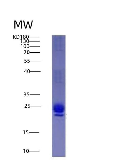 SDS-PAGE analysis of Human IL1RN (Interleukin-1 Receptor Antagonist Protein) - Recombinant Protein, CAT# BLT-05087P, showing >95% purity under 15% SDS-PAGE (Reduced)Human IL1RN (Interleukin-1 Receptor Antagonist Protein) - Recombinant Protein