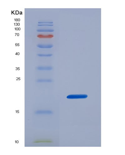 SDS-PAGE analysis of Mouse Il17b (Interleukin-17B) - Recombinant Protein, CAT# BLT-07204P, showing >90% purity under 15% SDS-PAGE (Reduced)Mouse Il17b (Interleukin-17B) - Recombinant Protein
