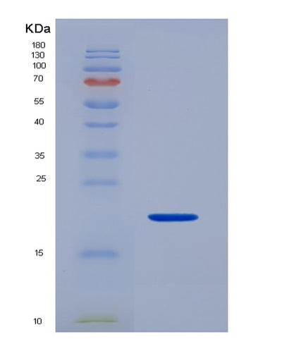 SDS-PAGE analysis of Human ADAMTS5 (A Disintegrin And Metalloproteinase With Thrombospondin Motifs 5) - Recombinant Protein, CAT# BLT-07206P, showing >90% purity under 15% SDS-PAGE (Reduced)Human ADAMTS5 (A Disintegrin And Metalloproteinase With Thrombospondin Motifs 5) - Recombinant Protein