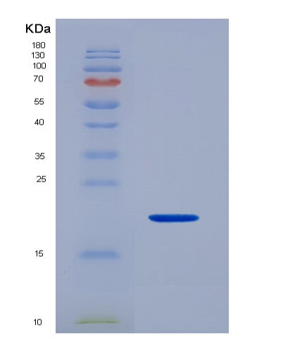 SDS-PAGE analysis of Human ADAMTS5 (A Disintegrin And Metalloproteinase With Thrombospondin Motifs 5) - Recombinant Protein, CATHuman ADAMTS5 (A Disintegrin And Metalloproteinase With Thrombospondin Motifs 5) - Recombinant Protein