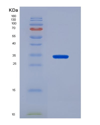 SDS-PAGE analysis of Human ABCG2 (Broad Substrate Specificity Atp-Binding Cassette Transporter Abcg2) - Recombinant Protein, CAT# BLT-07207P, showing >90% purity under 15% SDS-PAGE (Reduced)Human ABCG2 (Broad Substrate Specificity Atp-Binding Cassette Transporter Abcg2) - Recombinant Protein