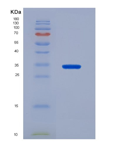 SDS-PAGE analysis of Human ABCG2 (Broad Substrate Specificity Atp-Binding Cassette Transporter Abcg2) - Recombinant Protein, CATHuman ABCG2 (Broad Substrate Specificity Atp-Binding Cassette Transporter Abcg2) - Recombinant Protein