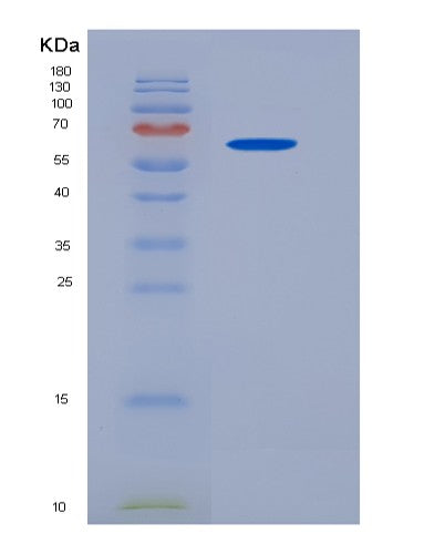 SDS-PAGE analysis of Human TERT (Telomerase Reverse Transcriptase) - Recombinant Protein, CATHuman TERT (Telomerase Reverse Transcriptase) - Recombinant Protein