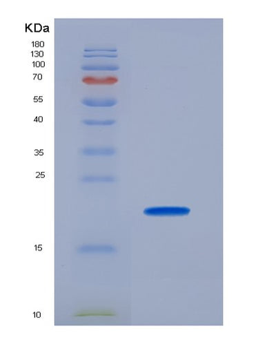SDS-PAGE analysis of Human COL17A1 (Collagen Alpha-1(Xvii) Chain) - Recombinant Protein, CAT# BLT-07211P, showing >90% purity under 15% SDS-PAGE (Reduced)Human COL17A1 (Collagen Alpha-1(Xvii) Chain) - Recombinant Protein