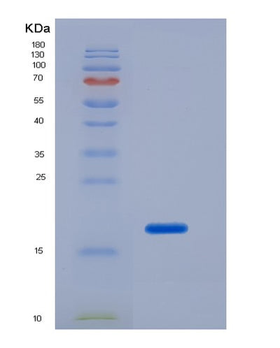 SDS-PAGE analysis of Human IL2 (Interleukin-2) - Recombinant Protein, CAT# BLT-03487P, showing >95% purity under 15% SDS-PAGE (Reduced)Human IL2 (Interleukin-2) - Recombinant Protein
