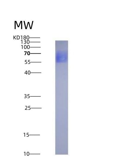 SDS-PAGE analysis of Human IL6R (Interleukin-6 Receptor Subunit Alpha) - Recombinant Protein, CAT# BLT-07041P, showing >95% purity under 15% SDS-PAGE (Reduced)Human IL6R (Interleukin-6 Receptor Subunit Alpha) - Recombinant Protein