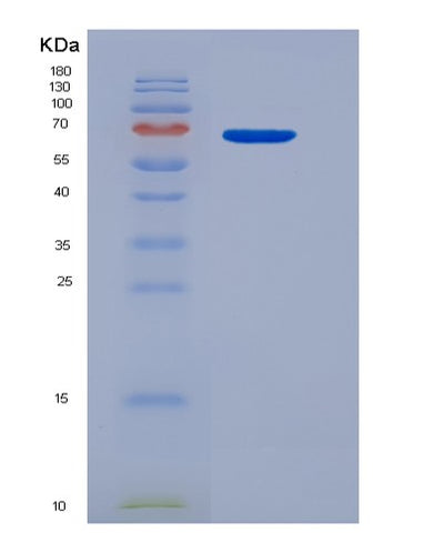 SDS-PAGE analysis of Human IL13 (Interleukin-13) - Recombinant Protein, CAT# BLT-04645P, showing >95% purity under 15% SDS-PAGE (Reduced)Human IL13 (Interleukin-13) - Recombinant Protein