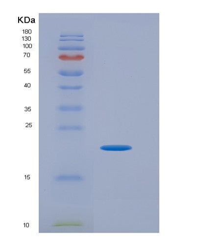 SDS-PAGE analysis of Human IL16 (Pro-Interleukin-16) - Recombinant Protein, CATHuman IL16 (Pro-Interleukin-16) - Recombinant Protein