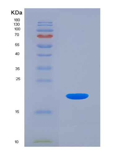 SDS-PAGE analysis of Human IL18 (Interleukin-18) - Recombinant Protein, CAT# BLT-04155P, showing >95% purity under 15% SDS-PAGE (Reduced)Human IL18 (Interleukin-18) - Recombinant Protein