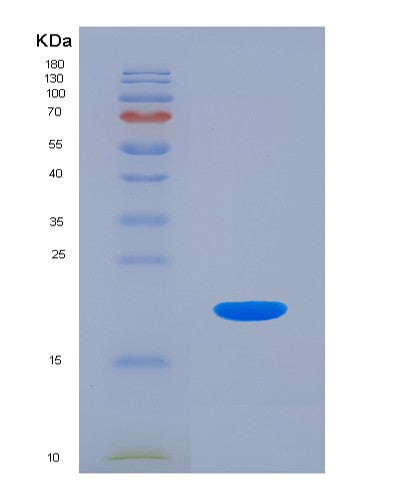 SDS-PAGE analysis of Human IL18 (Interleukin-18) - Recombinant Protein, CATHuman IL18 (Interleukin-18) - Recombinant Protein