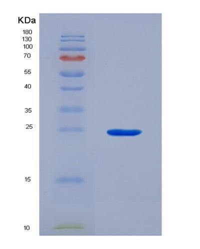 SDS-PAGE analysis of Human GCLC (Glutamate--Cysteine Ligase Catalytic Subunit) - Recombinant Protein, CAT# BLT-07212P, showing >90% purity under 15% SDS-PAGE (Reduced)Human GCLC (Glutamate--Cysteine Ligase Catalytic Subunit) - Recombinant Protein