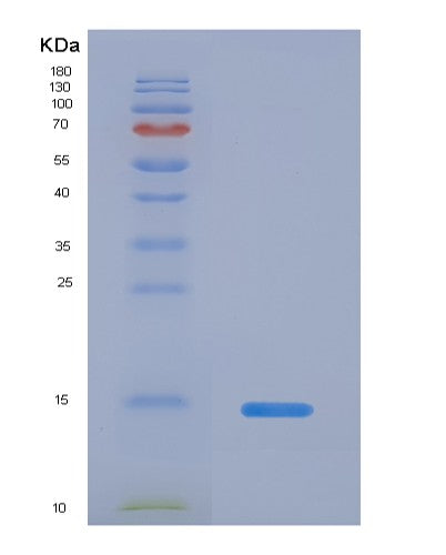 SDS-PAGE analysis of Human IL5 (Interleukin-5) - Recombinant Protein, CATHuman IL5 (Interleukin-5) - Recombinant Protein