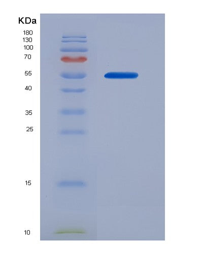 SDS-PAGE analysis of Human CANX (Calnexin) - Recombinant Protein, CATHuman CANX (Calnexin) - Recombinant Protein