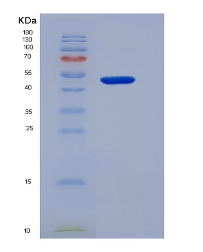 SDS-PAGE analysis of Human CHRNG (Acetylcholine Receptor Subunit Gamma) - Recombinant Protein, CAT# BLT-07215P, showing >90% purity under 15% SDS-PAGE (Reduced)Human CHRNG (Acetylcholine Receptor Subunit Gamma) - Recombinant Protein