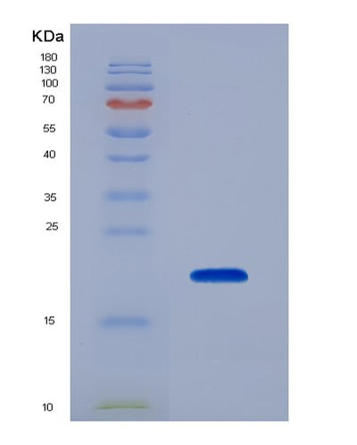 SDS-PAGE analysis of Mouse Rxfp1 (Relaxin Receptor 1) - Recombinant Protein, CAT# BLT-07216P, showing >90% purity under 15% SDS-PAGE (Reduced)Mouse Rxfp1 (Relaxin Receptor 1) - Recombinant Protein
